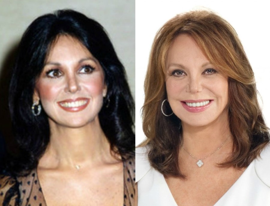 Marlo Thomas Plastic surgery for 76 year old!