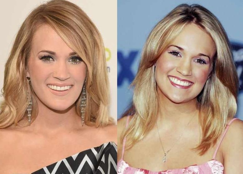Carrie Underwood Plastic surgery modifications