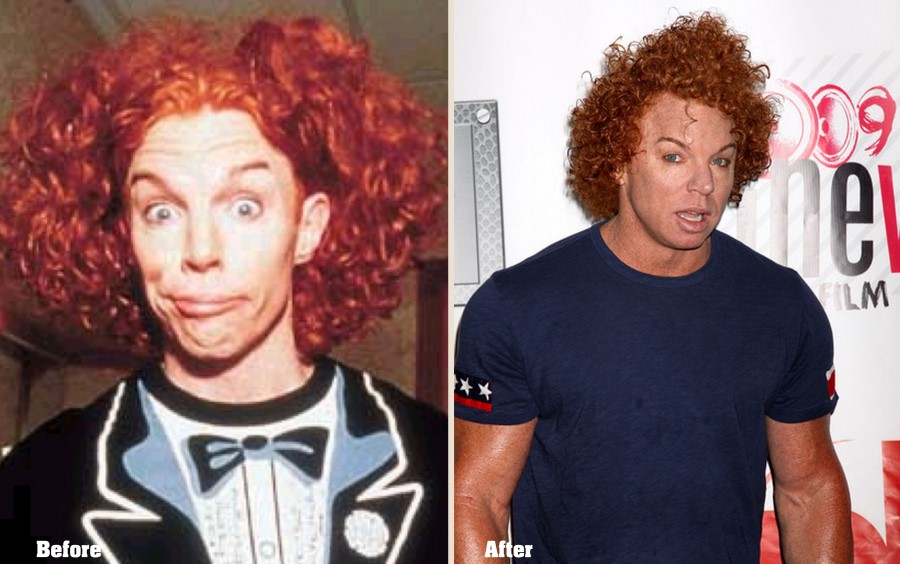Carrot Top Before And After Plastic Surgery 04 Celebrity Plastic Carrot Top Before And After Plastic Surgery 04 Celebrity Plastic
