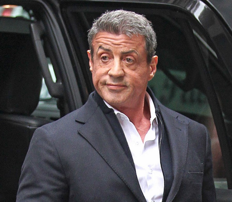 Sylvester Stallone after plastic surgery 02 Celebrity