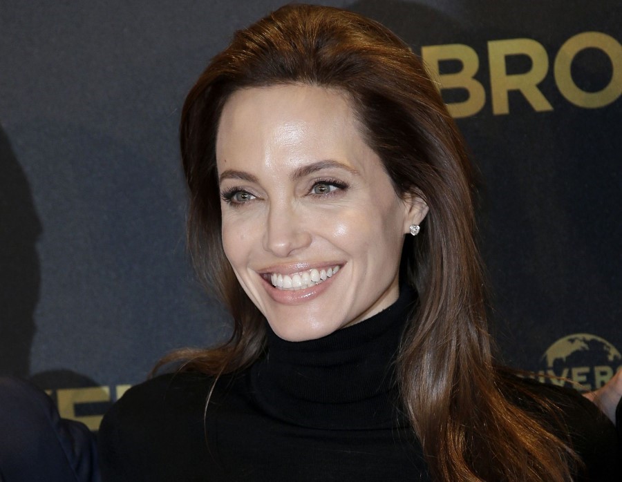 Angelina Jolie Plastic surgery 03 Celebrity plastic