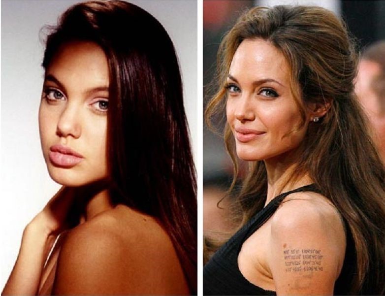 Angelina Jolie before and after plastic surgery 11