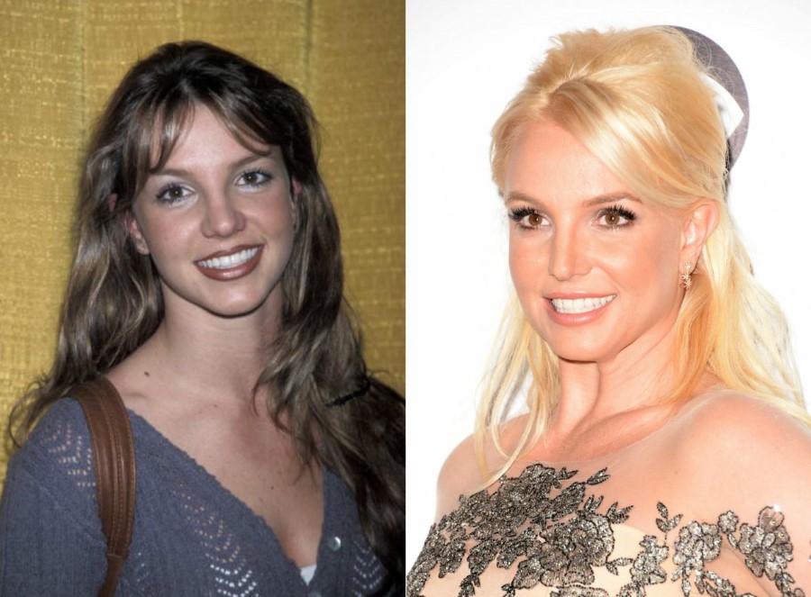 Britney-Spears-before-and-after-plastic-