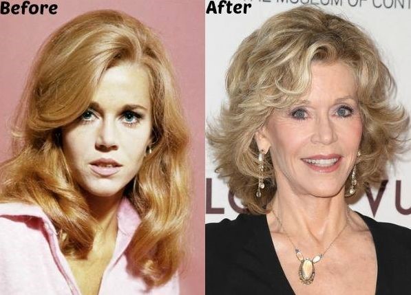 Jane-Fonda-before-and-after-plastic-surgery-04.jpg