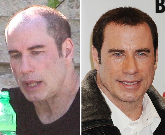 Image result for john travolta cosmetic surgery