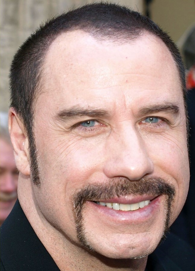 John Travolta plastic surgery Celebrity plastic surgery