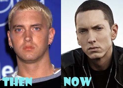 eminem surgery before plastic after botox good chirurgie tom jones plastische his him bad old looks piercings lifestyle skin young