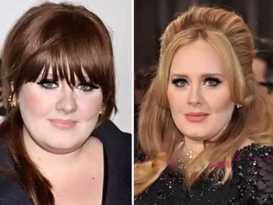 Adele Before And After Plastic Surgery 14 Celebrity Plastic Surgery