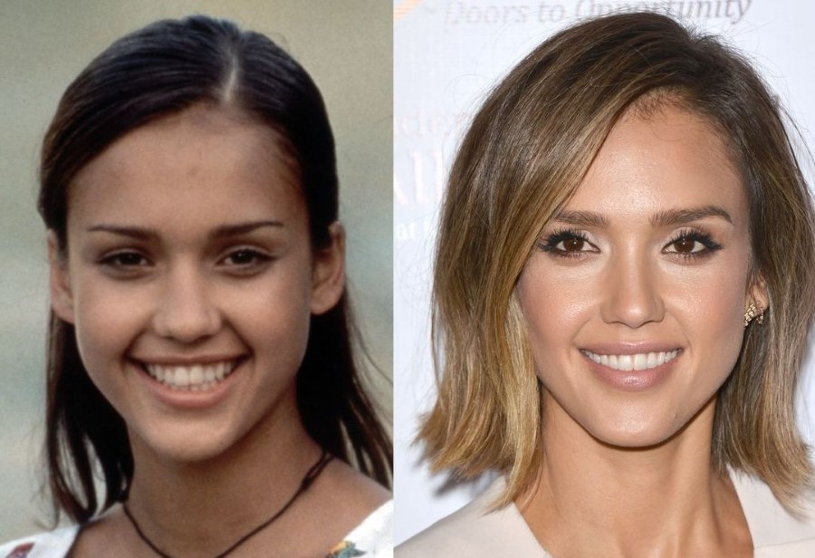 Jessica Alba Plastic Surgery or Is She Blessed by Nature?