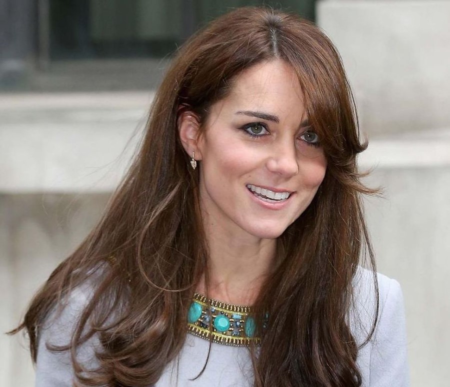 Kate Middleton plastic surgery 48 Celebrity plastic surgery online