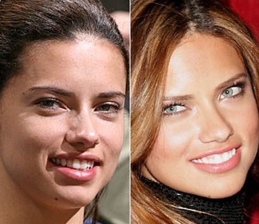 Adriana Lima Before And After Plastic Surgery 16 Celebrity Plastic