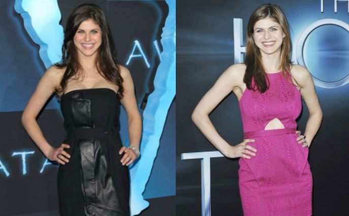 Alexandra Daddario Before And After Plastic Surgery 12 - Celebrity.
