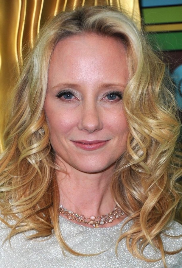 Anne Heche and plastic surgery
