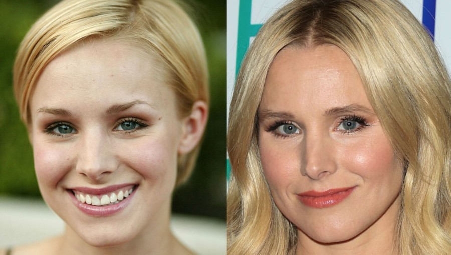 Kristen Bell I will never go for plastic surgery