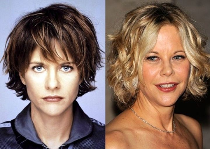 Meg Ryan before and after plastic surgery (22) Celebrity