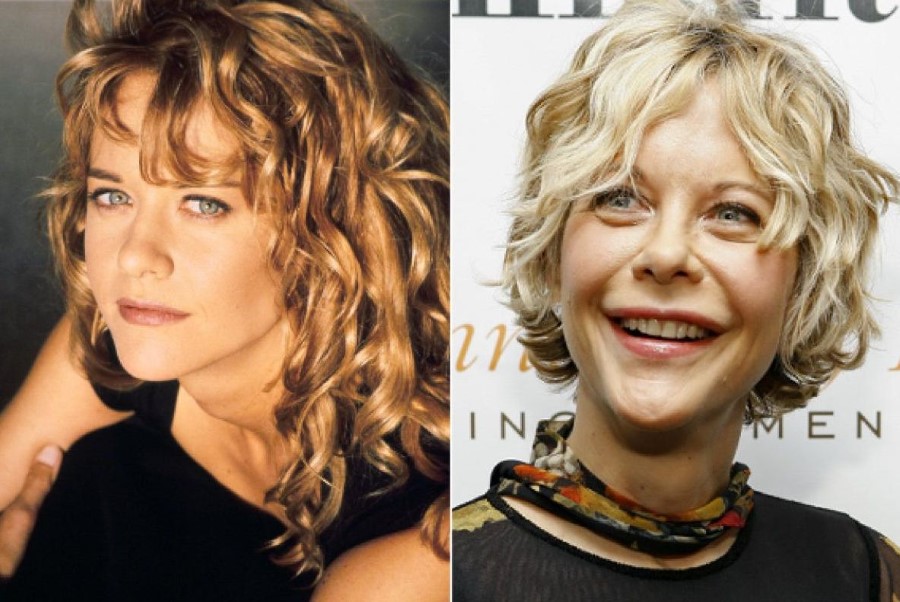 Meg Ryan before and after plastic surgery (9) Celebrity