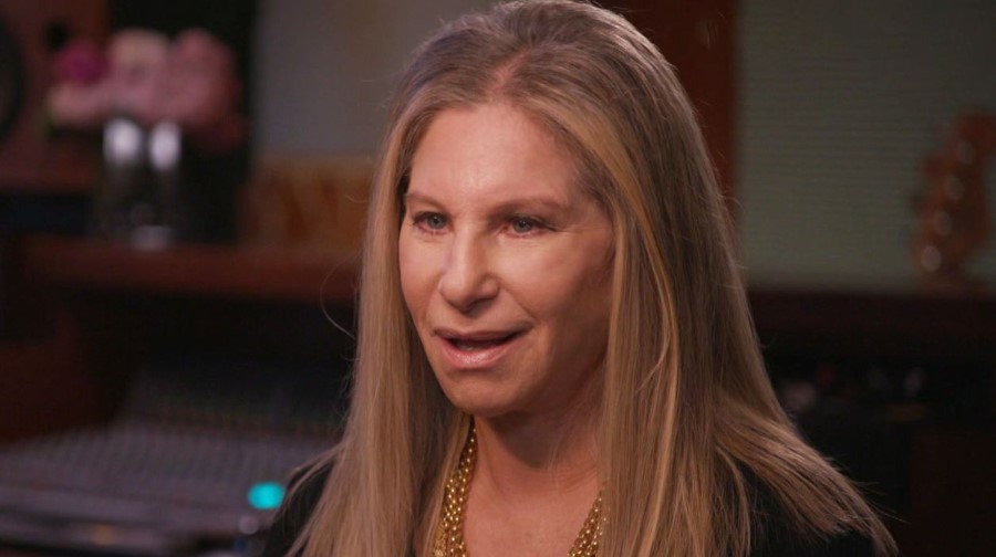 Barbra Streisand plastic surgery (34) Celebrity plastic