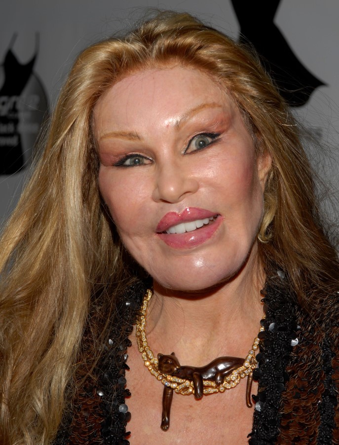 Jocelyn Wildenstein plastic surgery