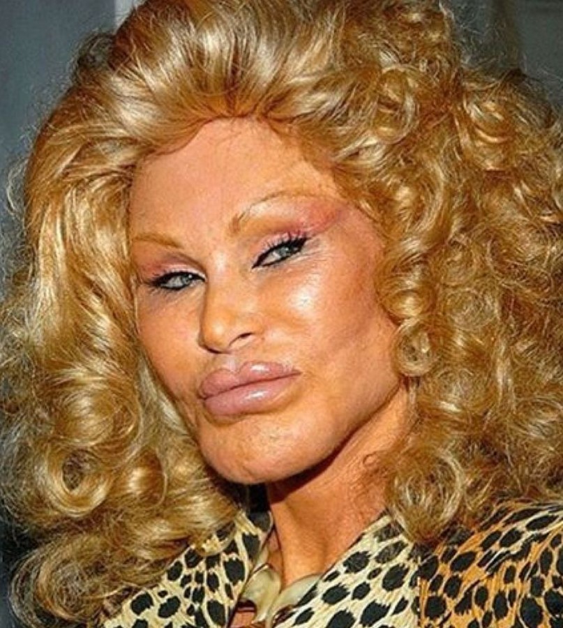 Jocelyn Wildenstein plastic surgery (24) Celebrity plastic surgery online
