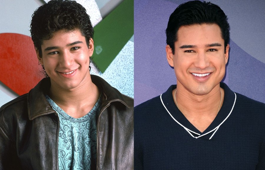 Mario Lopez plastic surgeries