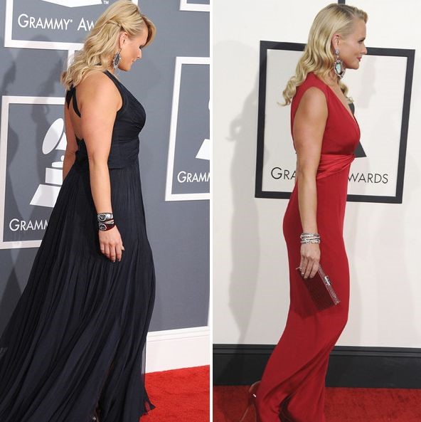 Miranda Lambert before and after plastic surgery (22