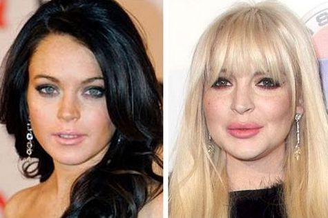 Lindsey Lohan - before and after