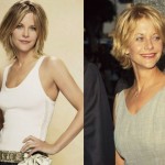 Meg Ryan plastic surgery 23