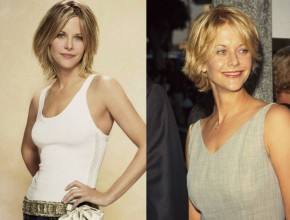 Meg Ryan plastic surgery 23