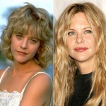 Meg Ryan plastic surgery 33