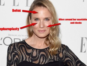 Rene Zellweger plastic surgery 62