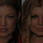 Fergie  before and after plastic surgery 81