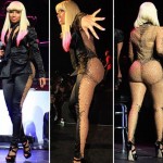 Nicki Minaj - plastic surgery 9