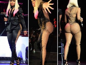 Nicki Minaj - plastic surgery 9