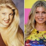 Fergie  before and after plastic surgery 91