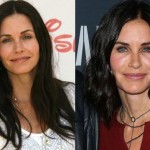 Courteney Cox before and after plastic surgery 2015