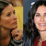 Courteney Cox before and after plastic surgery 2015 - 2