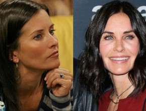 Courteney Cox before and after plastic surgery 2015 - 2