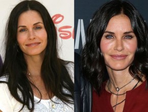 Courteney Cox before and after plastic surgery 2015