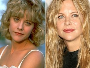 Meg Ryan before and after plastic surgery