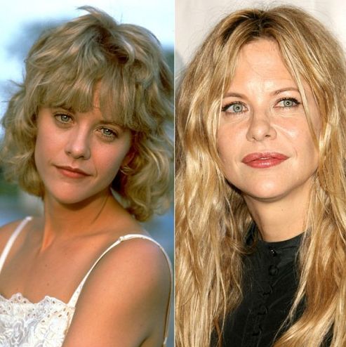 Meg Ryan before and after plastic surgery