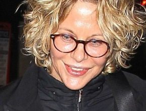Meg Ryan plastic surgery 17 (5)