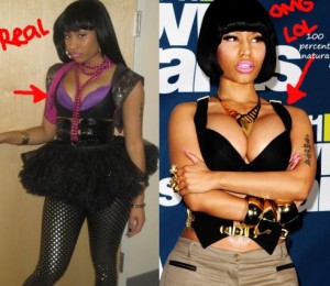 Nicki Minaj plastic surgery - Breast augmentation