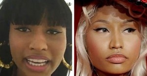 Nicki Minaj plastic surgery - rhynoplasty