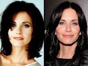 Courteney Cox before and after plastic surgery
