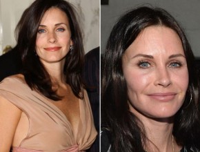 Courteney Cox before and after plastic surgery