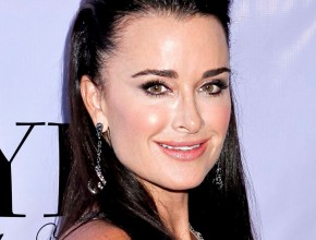 Kyle Richards plastic surgery 4