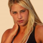 Anna Kournikova plastic surgery 084