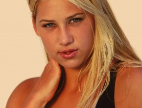 Anna Kournikova plastic surgery 084