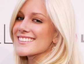 Heidi Montag plastic surgery 88