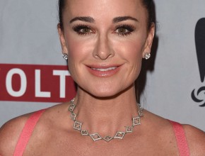 Kyle Richards plastic surgery 12